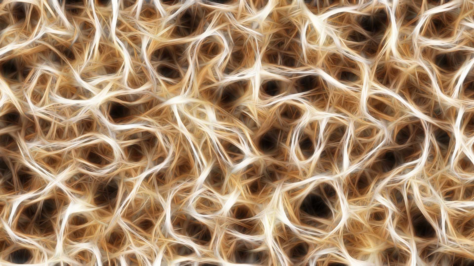 Neuronal Networks