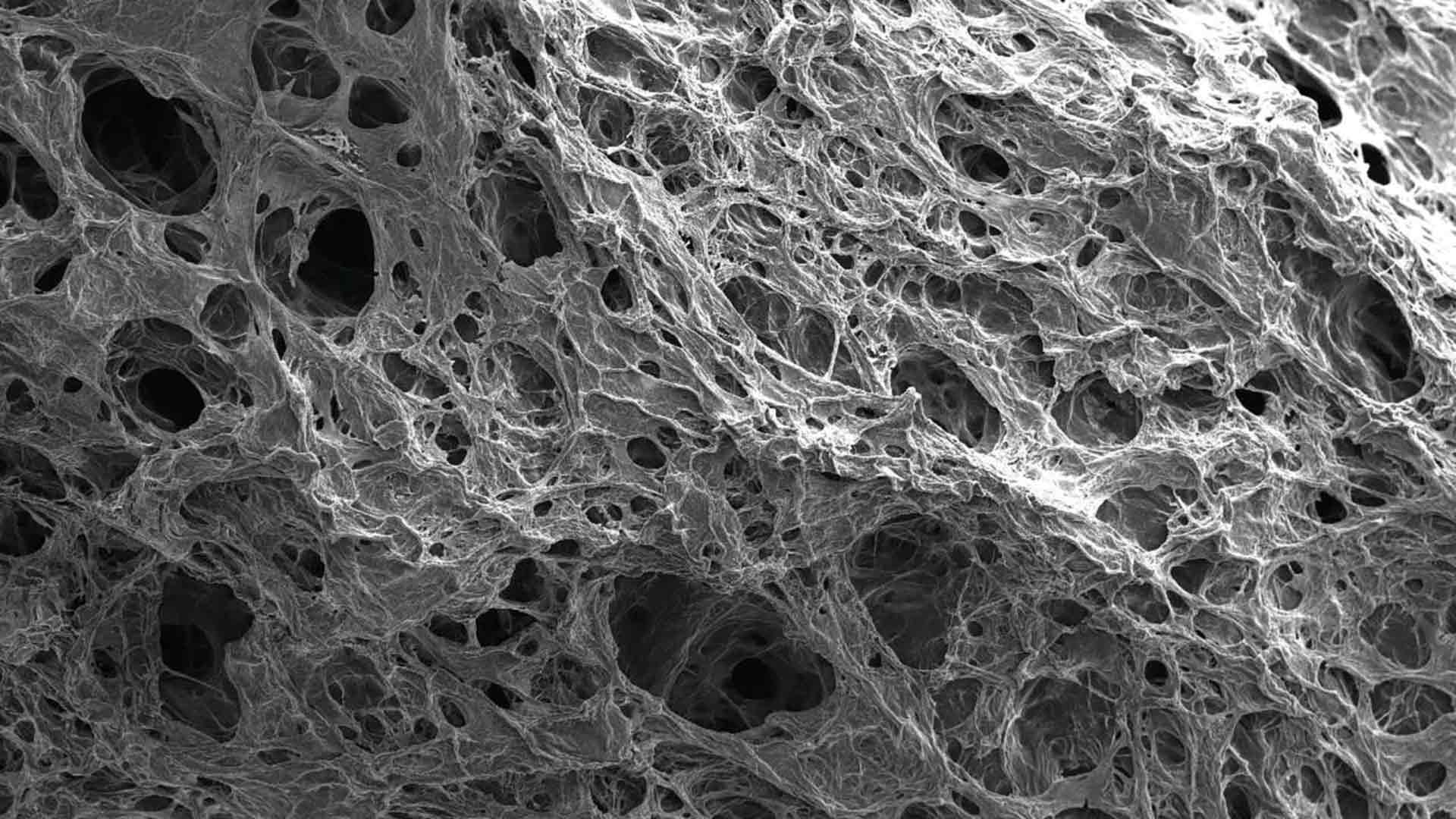 Magnified image of collagen.